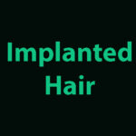 Implanted hair made with Synthetic Hair +$149.0
